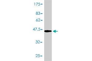 Western Blot detection against Immunogen (47. (PTGDS antibody  (AA 1-190))