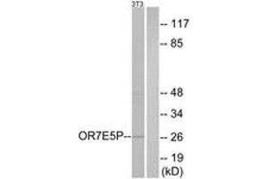 Western blot analysis of extracts from NIH-3T3 cells, using OR7E5P Antibody. (OR7E5P antibody  (AA 35-84))
