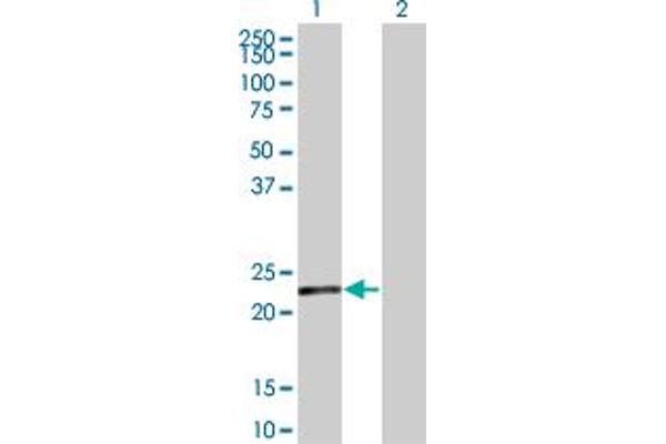 SENP8 antibody  (AA 113-212)