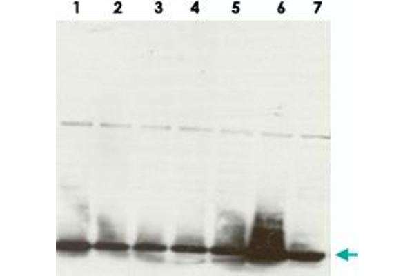HIST1H3A antibody  (3meLys27, pSer28)