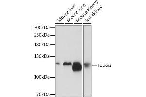 Western blot analysis of extracts of various cell lines, using Topors Rabbit pAb (ABIN7270855) at 1:1000 dilution. (TOPORS antibody)