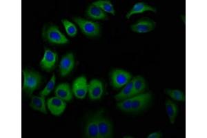 Immunofluorescence staining of A549 cells with ABIN7167453 at 1:100, counter-stained with DAPI. (STRA6 antibody  (AA 530-667))
