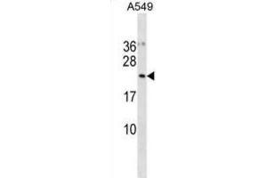 Western Blotting (WB) image for anti-Ubiquitin-Fold Modifier Conjugating Enzyme 1 (UFC1) antibody (ABIN3001127) (UFC1 antibody)