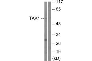 Western blot analysis of extracts from HepG2 cells, using TAK1 (epitope around residue 184) antibody. (TR4 antibody  (Thr184))