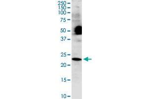 COX4NB monoclonal antibody (M01), clone 4F4. (COX4NB antibody  (AA 113-210))