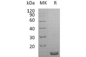 Western Blotting (WB) image for Interleukin 1 Receptor Antagonist (IL1RN) protein (ABIN7320549) (IL1RN Protein)