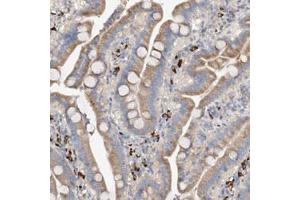 Immunohistochemical staining (Formalin-fixed paraffin-embedded sections) of human duodenum with SLC5A11 polyclonal antibody  shows moderate cytoplasmic positivity in glandular cells.