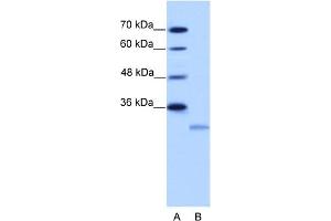 WB Suggested Anti-EIF4E2 Antibody Titration:  2. (EIF4E2 antibody  (N-Term))