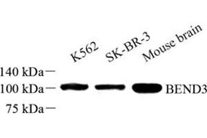 Western blot analysis of BEND3 (ABIN7073204) at dilution of 1: 500 (BEND3 antibody)