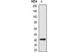 Western blot analysis of SIAT8D expression in HL60 (A) whole cell lysates. (ST8SIA4 antibody)
