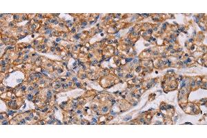 ARAP1 antibody