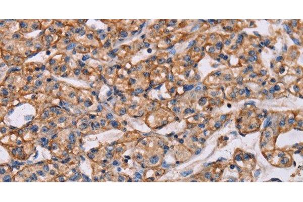 ARAP1 antibody