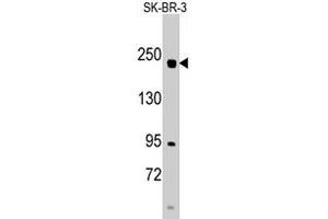 Western blot analysis of RICTOR polyclonal antibody  in SK-BR-3 cell line lysates (35 ug/lane). (RICTOR antibody  (N-Term))