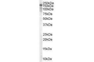 Image no. 1 for anti-Tuberous Sclerosis 1 (TSC1) (C-Term), (Isoform 1) antibody (ABIN374676)