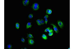 Immunofluorescent analysis of MCF-7 cells using ABIN7163997 at dilution of 1:100 and Alexa Fluor 488-congugated AffiniPure Goat Anti-Rabbit IgG(H+L) (KCNH7 antibody  (AA 1-300))