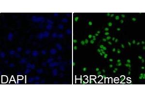 Immunofluorescence analysis of 293T cell using H3R2me2s antibody. (Histone 3 antibody  (H3R2me2s))