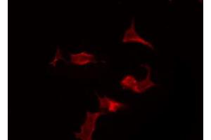 ABIN6266617 staining 293 by IF/ICC. (PAX5 antibody  (N-Term))