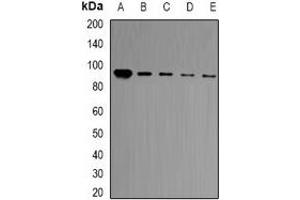 Western blot analysis of BCL11A expression in HT29 (A), Jurkat (B), Hela (C), A549 (D), mouse brain (E) whole cell lysates. (BCL11A antibody)