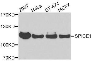 Western blot analysis of extracts of various cell lines, using SPICE1 antibody. (SPICE1 antibody  (AA 1-220))