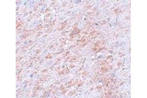 Immunohistochemistry (IHC) image for anti-Doublecortin-Like Kinase 2 (DCLK2) (C-Term) antibody (ABIN1030358) (DCLK2 antibody  (C-Term))