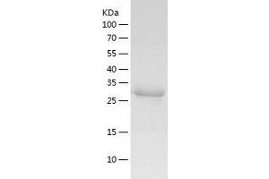 Western Blotting (WB) image for m7GpppX Diphosphatase (DCPS) (AA 1-337) protein (His tag) (ABIN7123820) (m7GpppX Diphosphatase (DCPS) (AA 1-337) protein (His tag))
