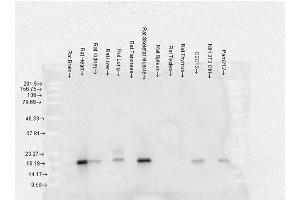 Western Blot analysis of Rat Brain, Heart, Kidney, Liver, Pancreas, Skeletal muscle, Spleen, Testes, Thymus cell lysates showing detection of Alpha B Crystallin protein using Mouse Anti-Alpha B Crystallin Monoclonal Antibody, Clone 3A10. (CRYAB antibody  (PerCP))