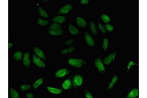 Immunofluorescent analysis of Hela cells using ABIN7160707 at dilution of 1: 100 and Alexa Fluor 488-congugated AffiniPure Goat Anti-Rabbit IgG(H+L) (NPL antibody  (AA 17-77))