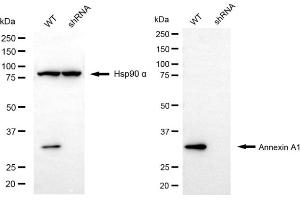 Western blotting analysis using annexin A1 antibody (ABIN7797611).