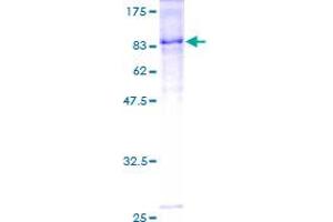 Image no. 1 for Intercellular Adhesion Molecule 1 (ICAM1) (AA 1-532) protein (GST tag) (ABIN1307324) (ICAM1 Protein (AA 1-532) (GST tag))