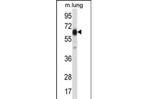 POF1B Antibody (Center) (ABIN657749 and ABIN2846733) western blot analysis in mouse lung tissue lysates (35 μg/lane). (POF1B antibody  (AA 337-366))