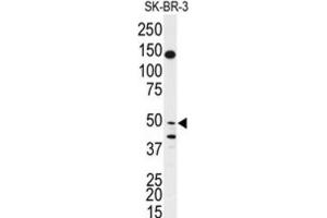 Western Blotting (WB) image for anti-BPI Fold Containing Family B, Member 2 (BPIFB2) antibody (ABIN3003205)