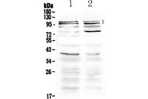 Western blot analysis of TRPC3 using anti-TRPC3 antibody .