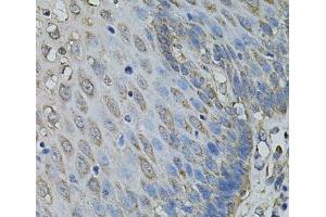 Immunohistochemistry of paraffin-embedded Human esophagus using IL1A Polyclonal Antibody at dilution of 1:100 (40x lens). (IL1A antibody)
