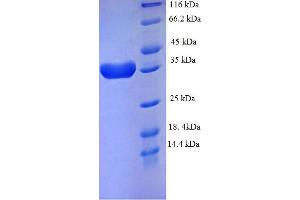 SDS-PAGE (SDS) image for Eukaryotic Translation Initiation Factor 4E Binding Protein 2 (EIF4EBP2) (AA 1-120), (full length) protein (GST tag) (ABIN4975638) (eIF4EBP2 Protein (AA 1-120, full length) (GST tag))