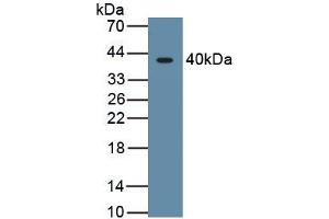 Detection of Recombinant HIF1a, Human using Monoclonal Antibody to Hypoxia Inducible Factor 1 Alpha (HIF1a) (HIF1A antibody  (AA 218-506))