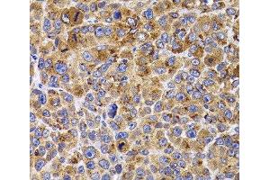 Immunohistochemistry of paraffin-embedded Mouse cancer using UBE2R2 Polyclonal Antibody at dilution of 1:100 (40x lens). (UBE2R2 antibody)