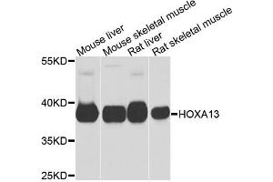 Western blot analysis of extracts of various cell lines, using HOXA13 antibody. (HOXA13 antibody)