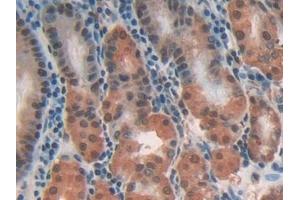 Detection of CLIC1 in Human Stomach Tissue using Polyclonal Antibody to Chloride Intracellular Channel Protein 1 (CLIC1) (CLIC1 antibody  (AA 79-241))