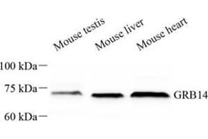 Western blot analysis of GRB14 (ABIN7074135) at dilution of 1: 500 (GRB14 antibody)
