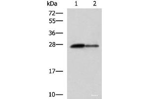 Western blot analysis of Rat pancreas tissue and Mouse pancreas tissue lysates using CTRB1 Polyclonal Antibody at dilution of 1:1000 (CTRB1 antibody)