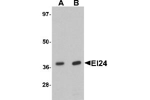 Western blot analysis of EI24 in rat liver tissue lysate with EI24 antibody at (A) 1 and (B) 2 µg/mL. (EI24 antibody  (C-Term))