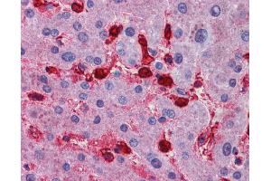 Immunohistochemistry (IHC) image for anti-Mitogen-Activated Protein Kinase Kinase Kinase Kinase 4 (MAP4K4) (N-Term) antibody (ABIN2783612) (MAP4K4 antibody  (N-Term))