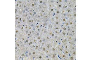 Immunohistochemistry of paraffin-embedded rat liver using SPHK1 Antibody (ABIN5970017) at dilution of 1/200 (40x lens). (SPHK1 antibody)