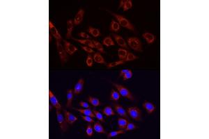 Immunofluorescence analysis of NIH/3T3 cells using PI3 Kinase p85 alpha antibody (ABIN6130617, ABIN6145642, ABIN6145645 and ABIN6215197) at dilution of 1:100.