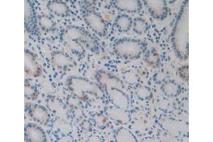 IHC-P analysis of Human Stomach Tissue, with DAB staining. (EBI3 antibody)