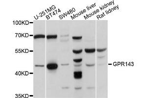 Western blot analysis of extracts of various cells, using GPR143 antibody. (GPR143 antibody)