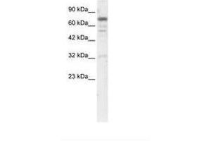 Image no. 1 for anti-Ras and Rab Interactor 3 (RIN3) (AA 82-131) antibody (ABIN202959) (RIN3 antibody  (AA 82-131))