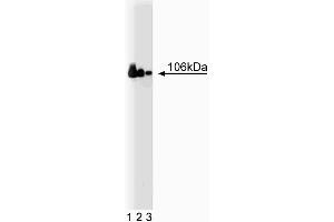 Western blot analysis of Adaptin beta on a Jurkat cell lysate (Human T-cell leukemia, ATCC TIB-152) (left). (AP2B1 antibody  (AA 75-245))