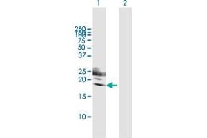 Western Blot analysis of KLRG1 expression in transfected 293T cell line by KLRG1 MaxPab polyclonal antibody. (KLRG1 antibody  (AA 1-189))