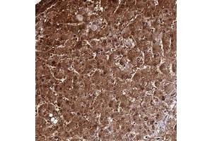 Immunohistochemical staining of human liver with DDX19A polyclonal antibody  shows strong cytoplasmic and nuclear positivity in hepatocytes at 1:500-1:1000 dilution. (DDX19A antibody)